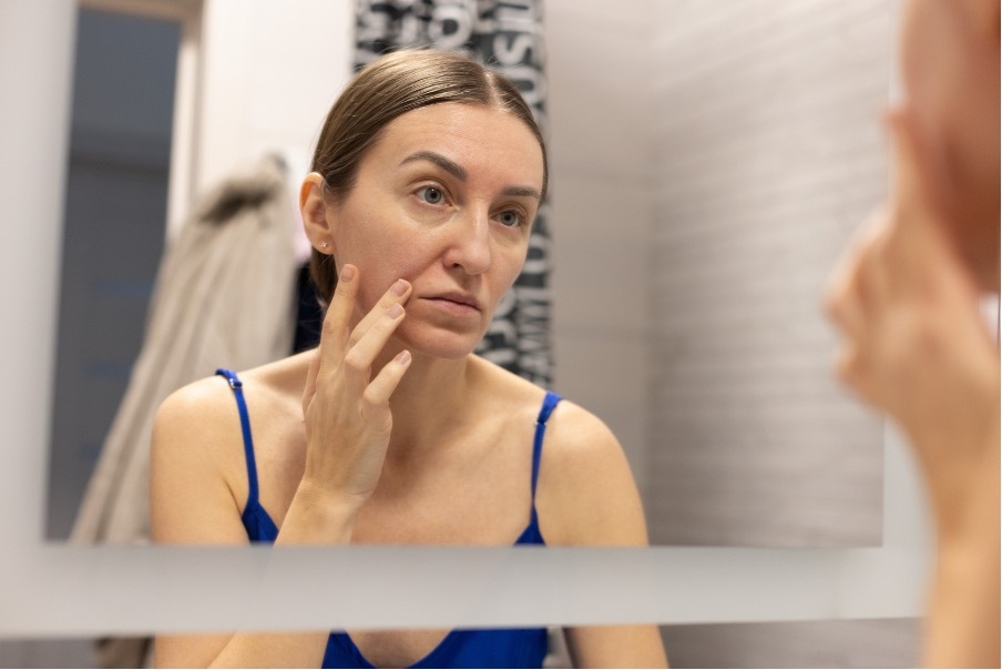 Donna che esamina la propria pelle allo specchio, immagine di copertina articolo sui cambiamenti cutanei in menopausa